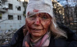 Guerra da Rússia contra a Ucrânia já deixou milhares de mortos